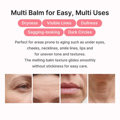 Kylora™ PDRN Pink Volume Balm